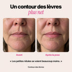 Avant et après, contour des lèvres